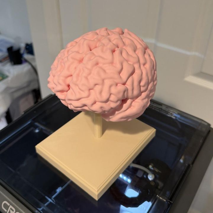 Pink PLA brain replica on a beige stand, modelled from the client’s MRI scan