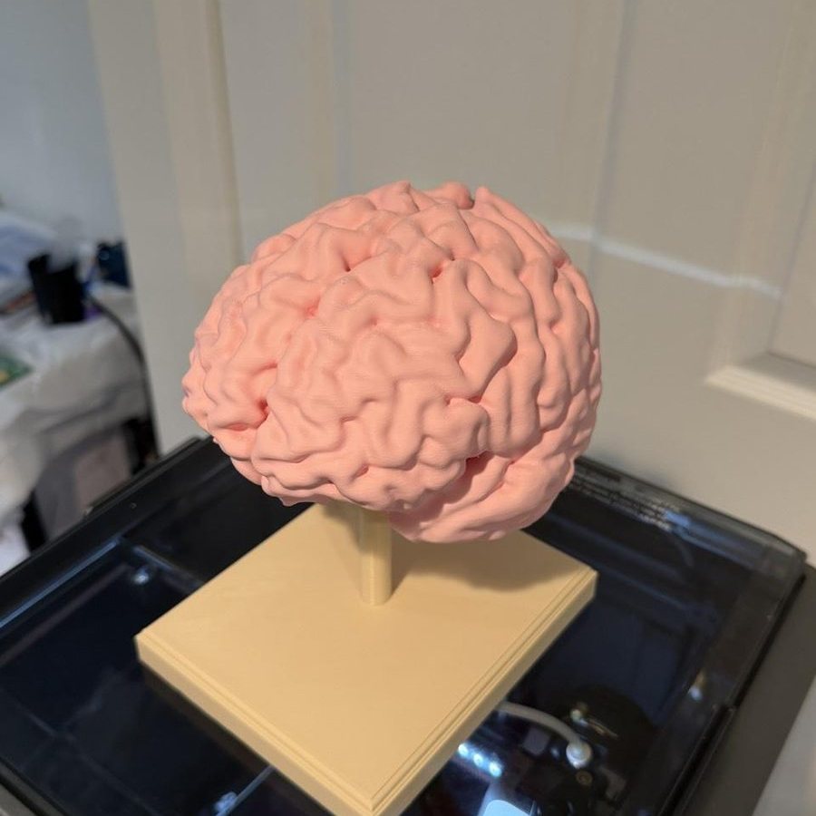 Photo of Real Brain Replica from MRI scan, a custom print job for Sea_Procedure7857